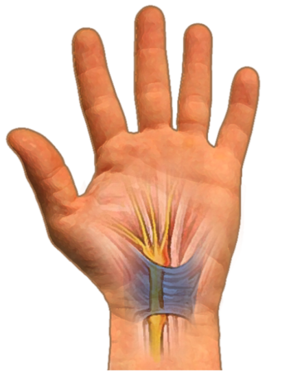 sindrom na karpalniq tunel