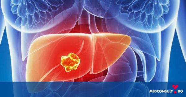 Възможно ли е лечение на чернодробни метастази без операция