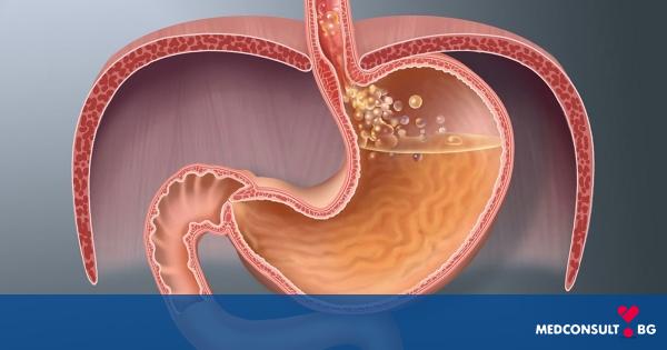 Гастроезофагеалната рефлуксна болест може да наподобява инфаркт на миокарда