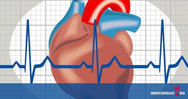 Нарушение на сърдечния ритъм